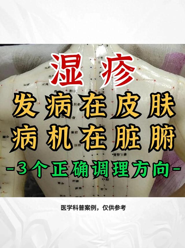 湿疹发病在肌肤，病机在脏腑，三个正确的调理方向，收藏