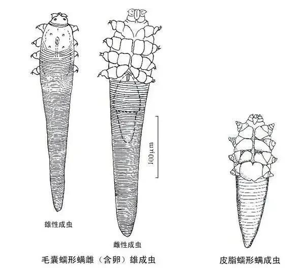 头皮出现这几种情况？警惕可能是它们在作祟！